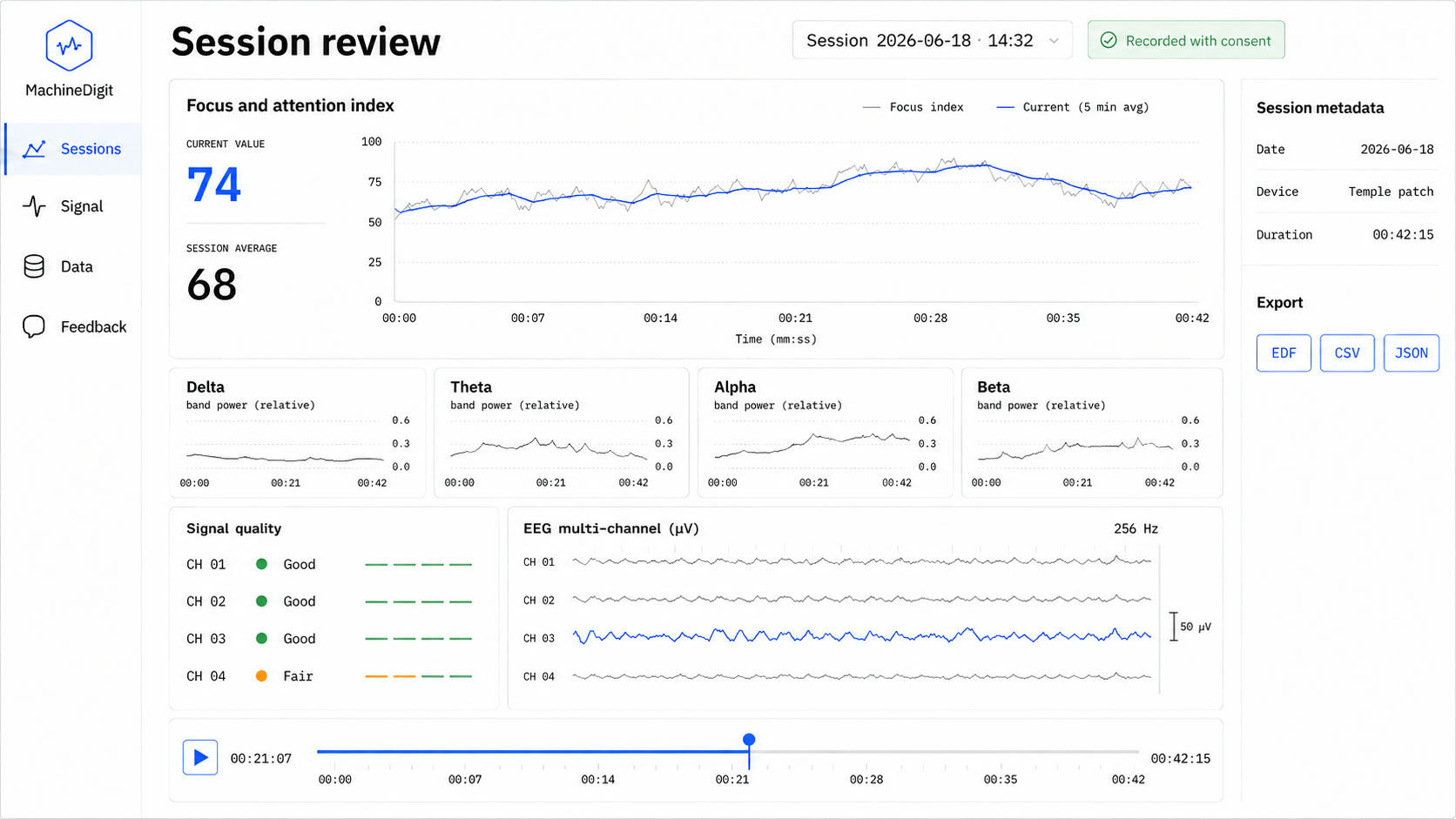 The MachineDigit beta dashboard session-review screen: a focus and attention index chart, delta, theta, alpha, and beta band-power tiles, per-channel signal quality across four channels, a 256 Hz EEG waveform, and EDF, CSV, and JSON export